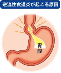 胃腸の病気 磯子区洋光台 ひかりクリニック 内科 胃カメラ 大腸カメラ 経鼻内視鏡 ピロリ菌 消化器内科 内科 外科